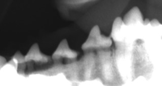 レントゲンでは歯槽骨が破壊されています